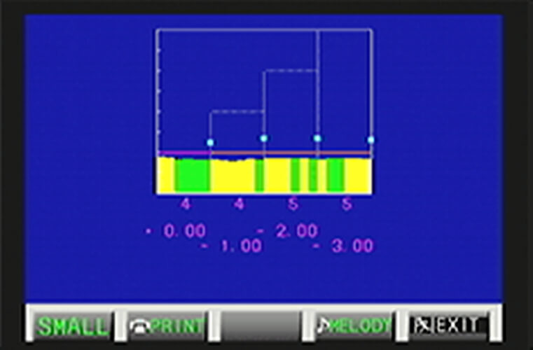 Autorefraktometr Acomoref 2 / K-model ekran