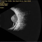 Ultrasonograf Keller B-Scan Plus